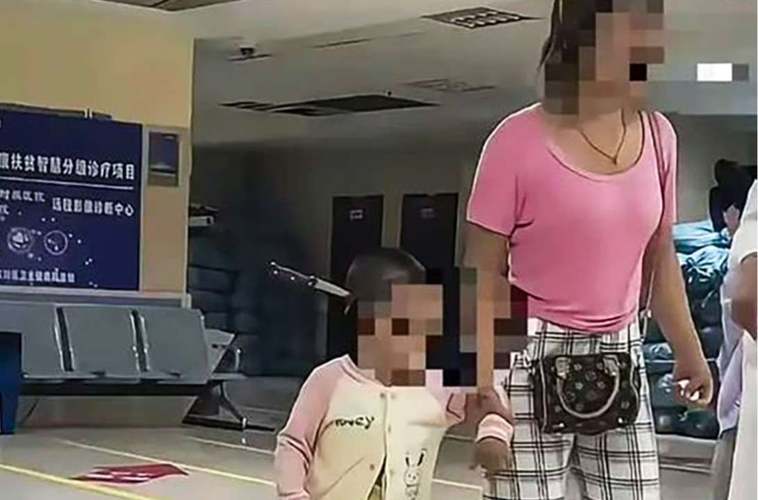 Una niña acude por su propio pie a un hospital con un cuchillo clavado en la cabeza